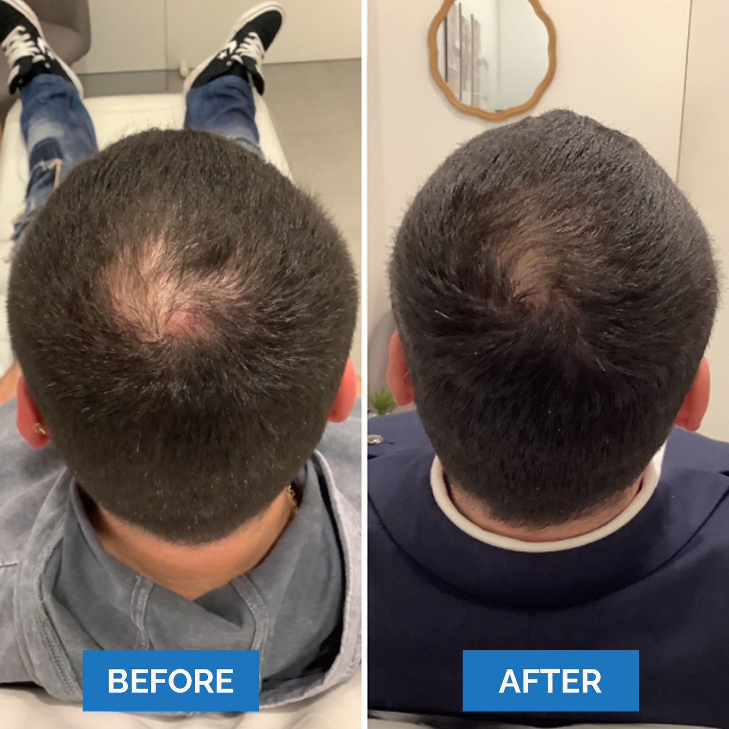 Seruvie™ - Hair Growth Serum