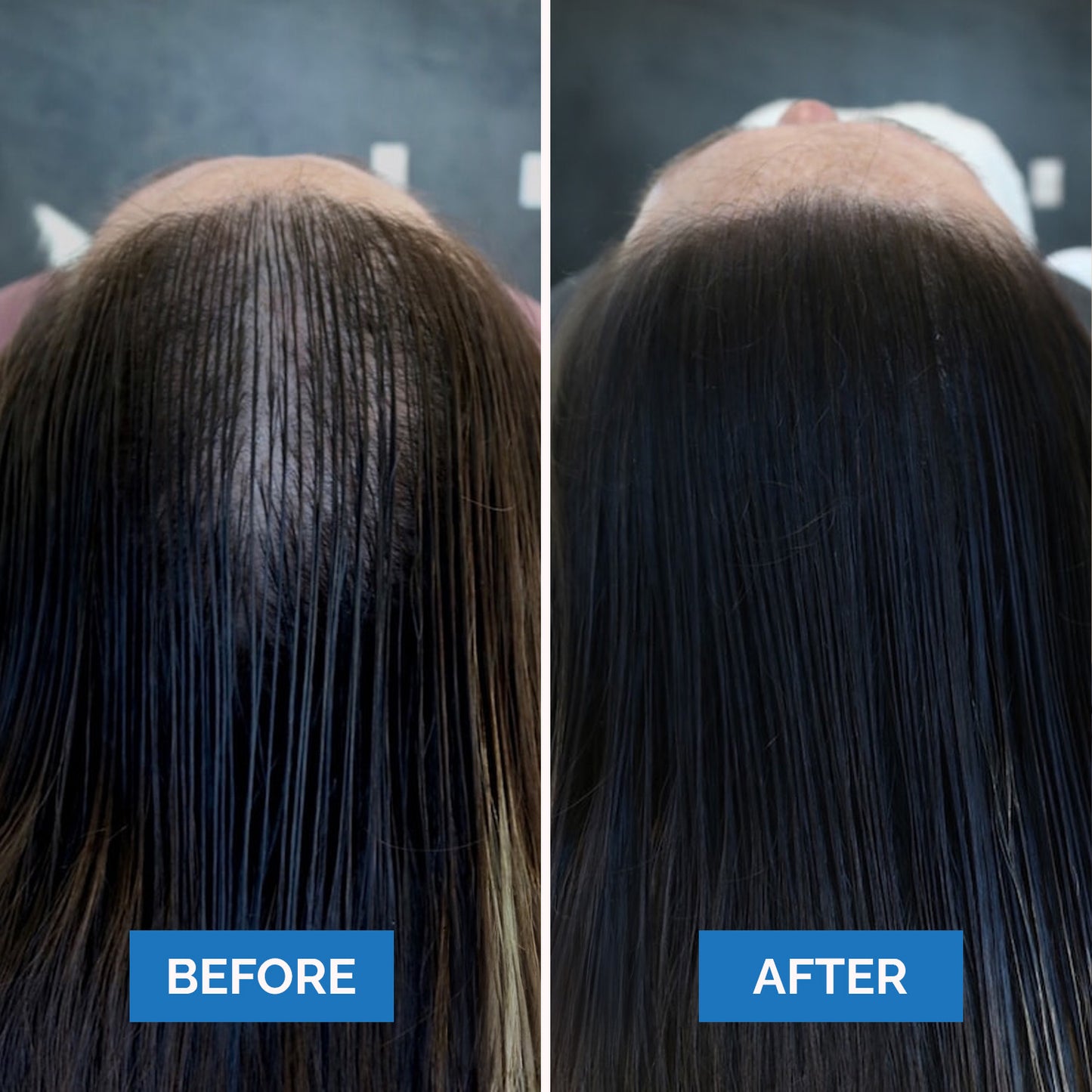 Seruvie™ - Hair Growth Serum