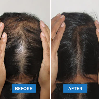 Seruvie™ - Hair Growth Serum