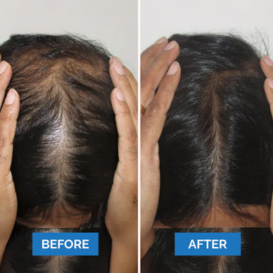 "Unlock Your Radiance with Luxurious, Full Hair"